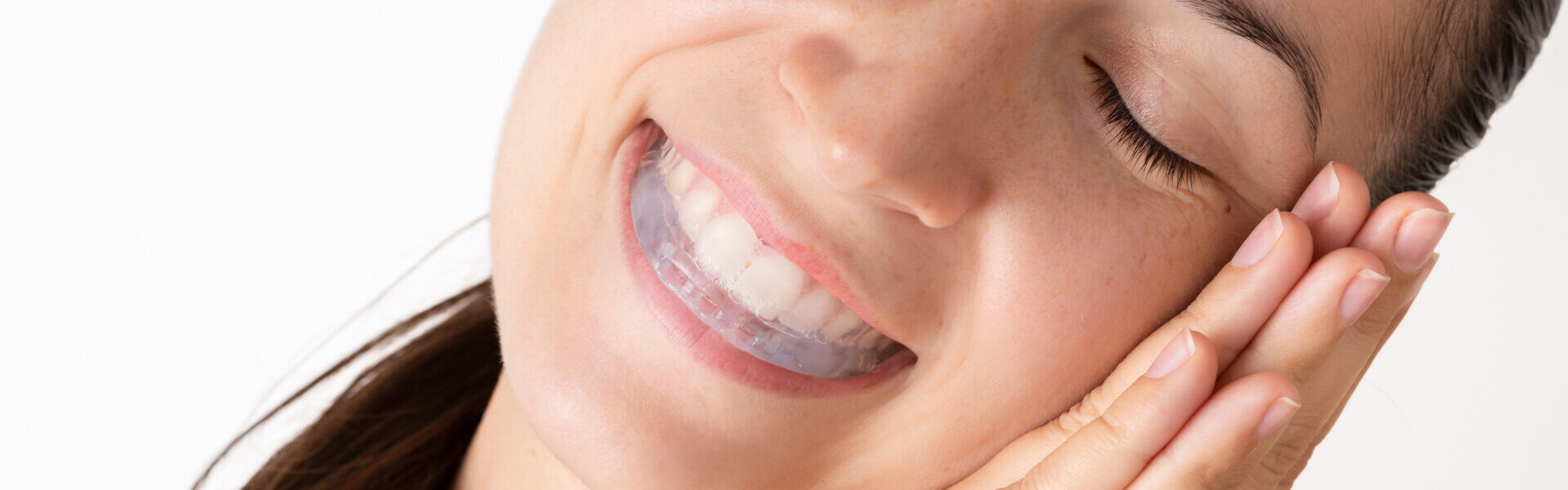 Bite Splint Anti-snoring device