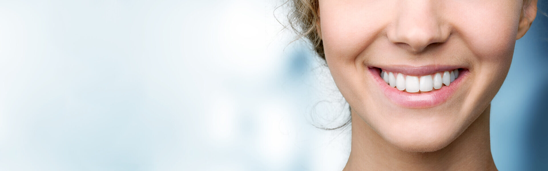 Smile Makeover